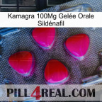 Kamagra 100Mg Gelée Orale Sildénafil 13